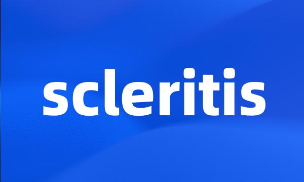 scleritis