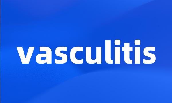 vasculitis